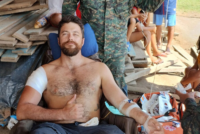 wounded man gives thumbs up while being attended by army medic after a gunfight during his Amazon River expedition